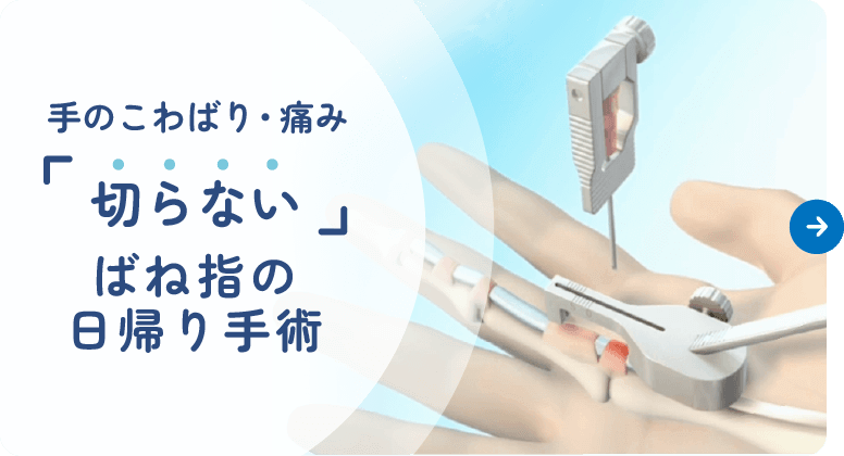 手のこわばり・痛み|『切らない』ばね指の日帰り手術