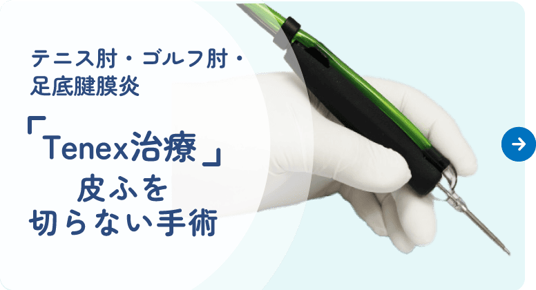 テニス肘・ゴルフ肘・足底腱膜炎『Tenex治療』 皮ふを切らない手術